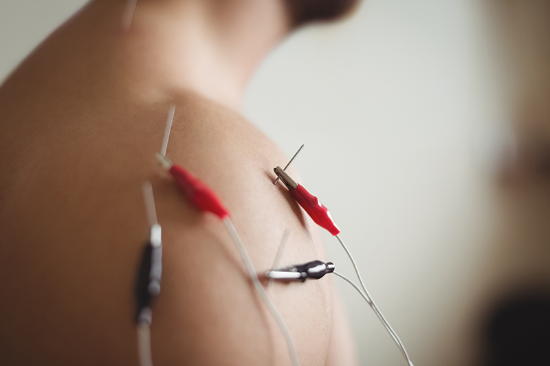 Acupuncturists Email Lists